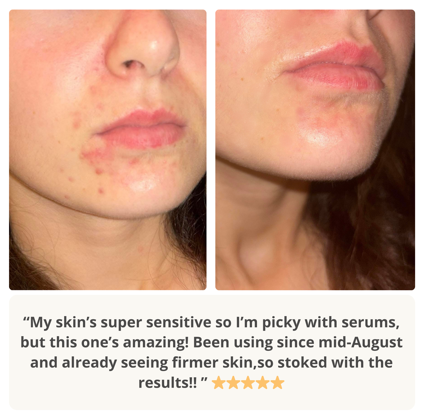 Skip The Sting Serum