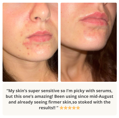 Skip The Sting Serum
