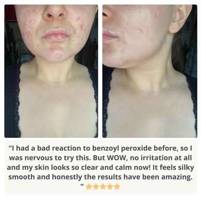 Skip The Sting Serum