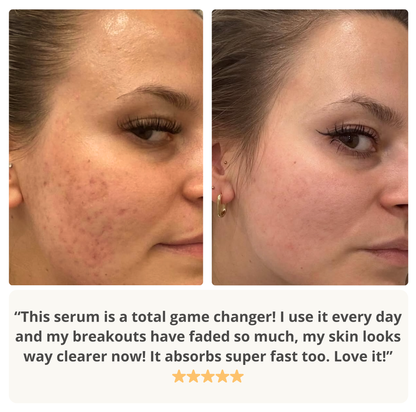 Skip The Sting Serum