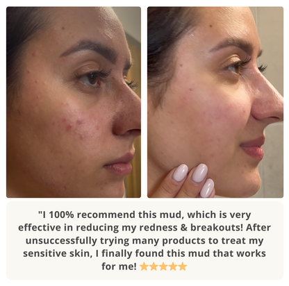 Mineral-Rich Dead Sea Mud Mask